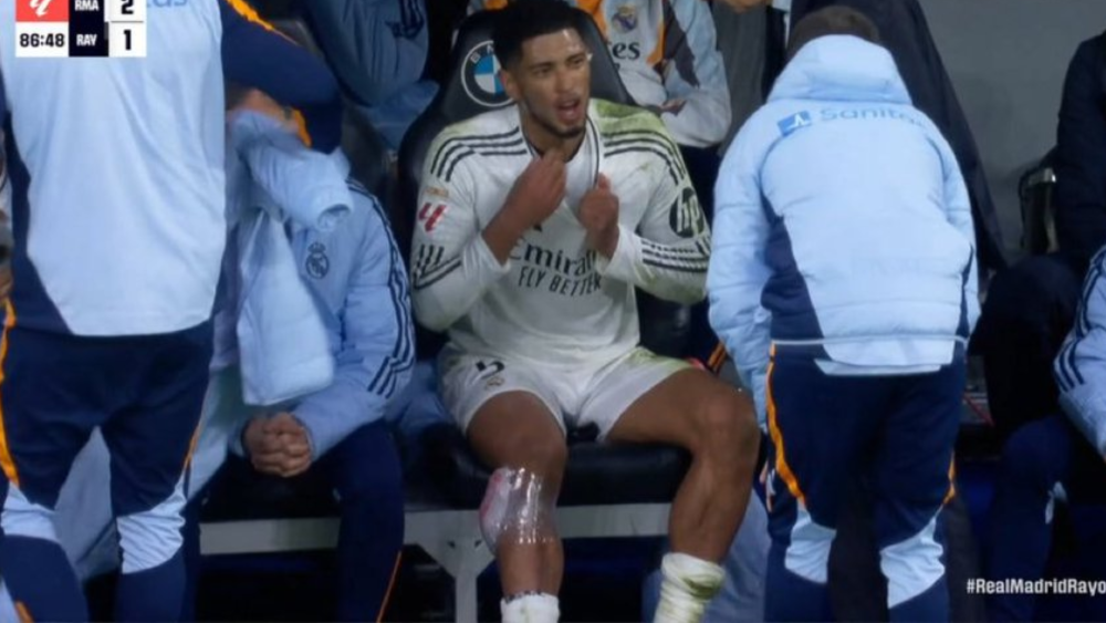 lesion bellingham madrid hielo